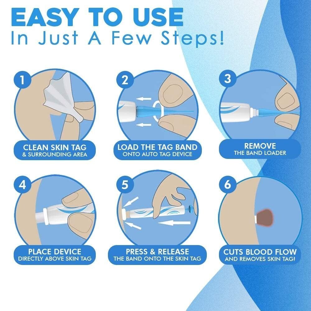Eaksone - fast auto tag removal kit