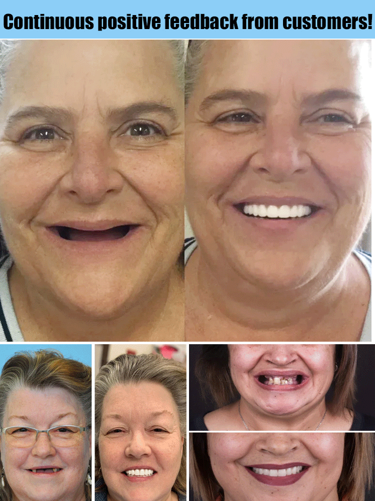 Eaksone - Full Denture Set