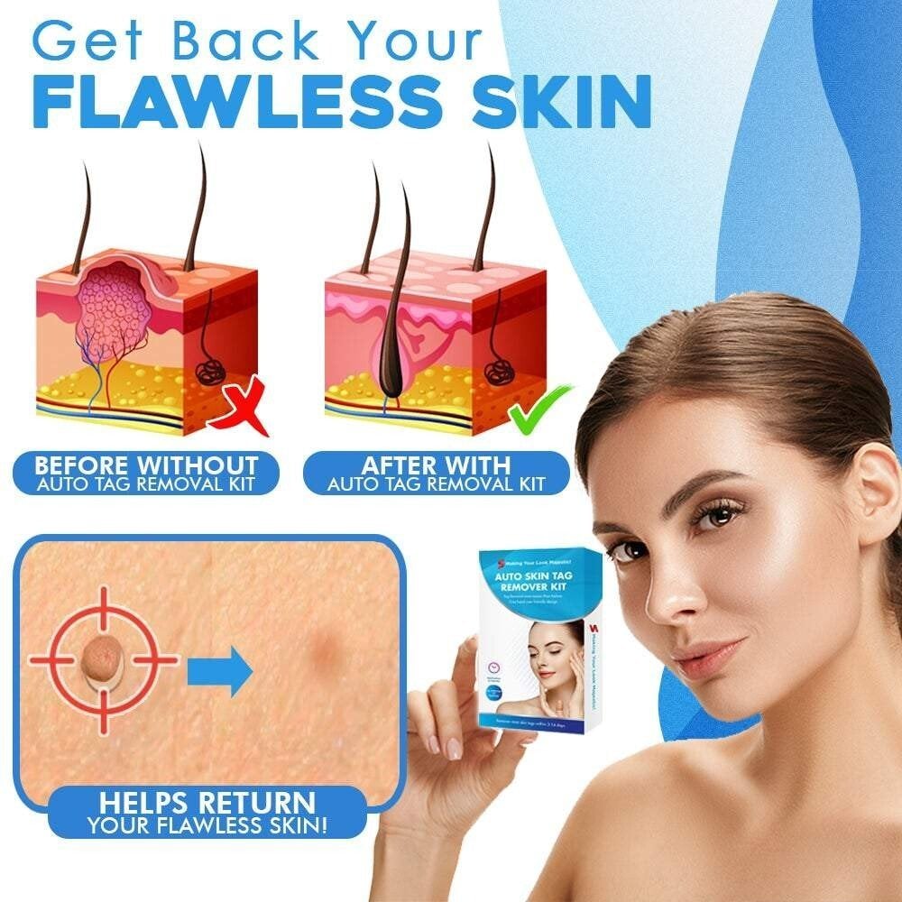 Eaksone - fast auto tag removal kit