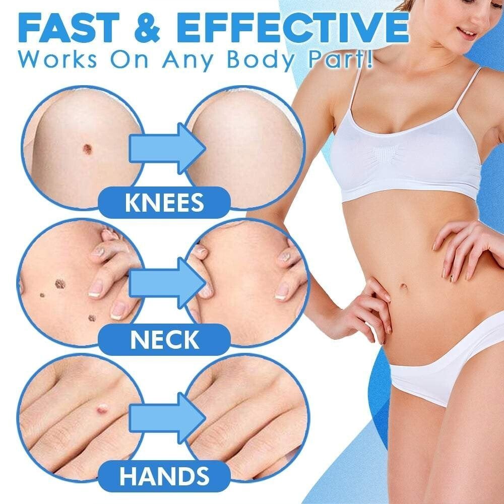 Eaksone - fast auto tag removal kit
